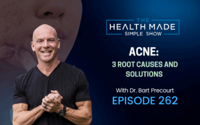 Acne: 3 root causes and solutions | Ep. 262